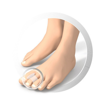 RUCK® smartgel, specjalistyczny separator pierścieniowy do stóp, średni, 4 szt.