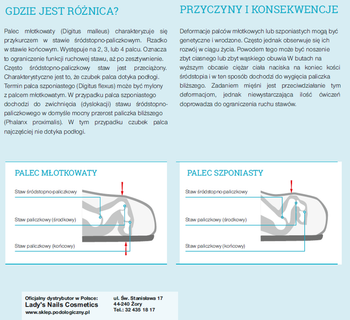 RUCK® basic skórzana orteza na palec młotkowy, mały, lewa, 2 szt.