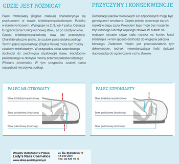 RUCK® smartgel, orteza na palec młotkowy z potrójnym pierścieniem, lewa, S/M, 2 szt.