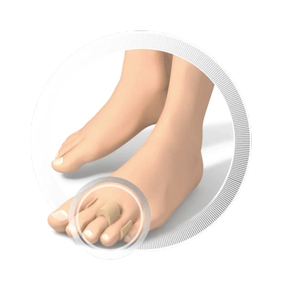 RUCK basic ochraniacz na palce młotkowate, 4 szt.