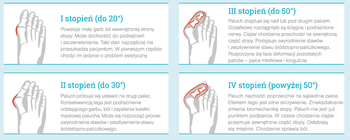 Profilaktyka Hallux Valgus - opaska korekcyjna, 34-42, 2 szt.