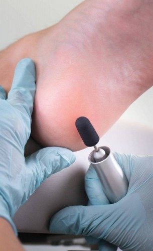 RUCK® jednorazowe kapturki MedCap do pedicure, Ø 7 mm / ziarn. 60 (10 szt.)