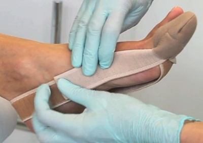 Profilaktyka Hallux Valgus - opaska korekcyjna, 43-47, 2 szt.